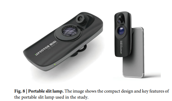 何氏科研团队多方合力发表AI研究成果为网格化社区青光眼早期筛查提供新方案